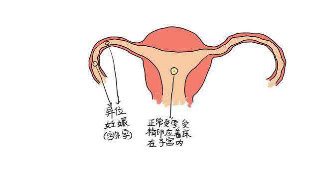 上海试管供卵咨询，咨询试管婴儿上海：您需要了解的五个问题