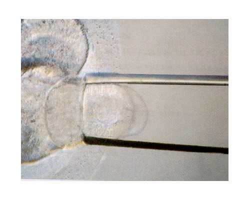 上海十院试管婴儿做试管婴儿多少钱？第二次为您揭秘！