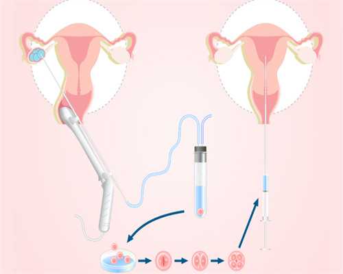 上海试管助孕排名,上海代妈待遇多少,上海高龄试管婴儿*率高吗 有哪些注意事