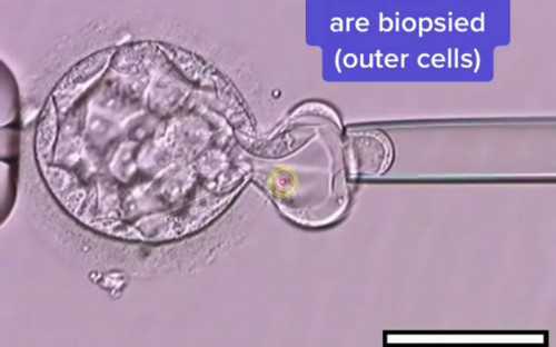 代孕可靠吗,试管婴儿双胞胎的费用是多少