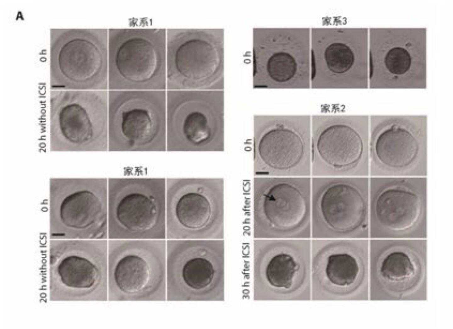 上海研究团队发现人类新遗传疾病“卵子死亡”